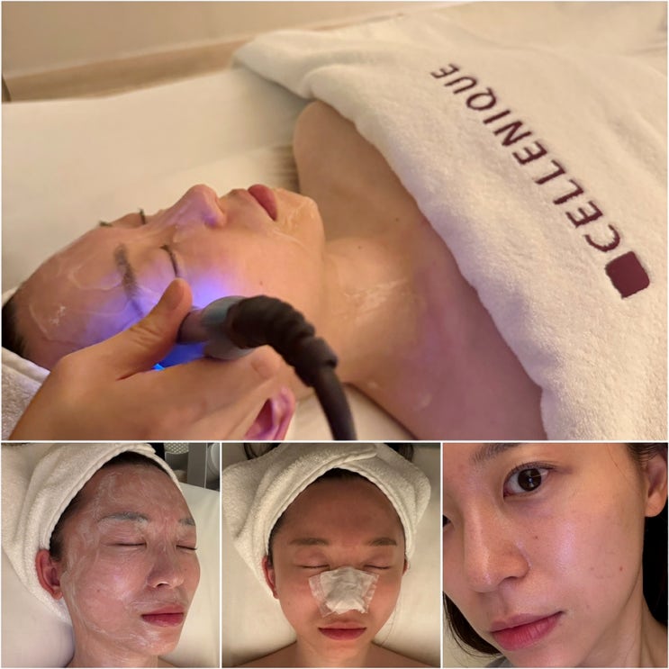  공덕에스테틱 세레니끄 피부관리 LDM 물방울 리프팅