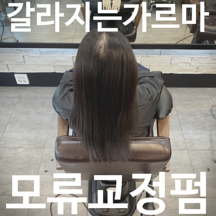  30대여자 가르마탈모, 링거펌으로 갈라짐 없이 자연스럽게
