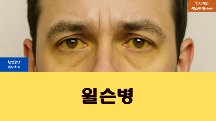  윌슨병 원인 증상 및 검사 치료