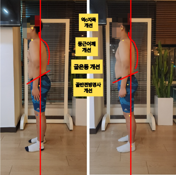  부산 서면 어린이자세교정, 우리 아이 키성장과 틀어진 자세가 걱정이시라면?