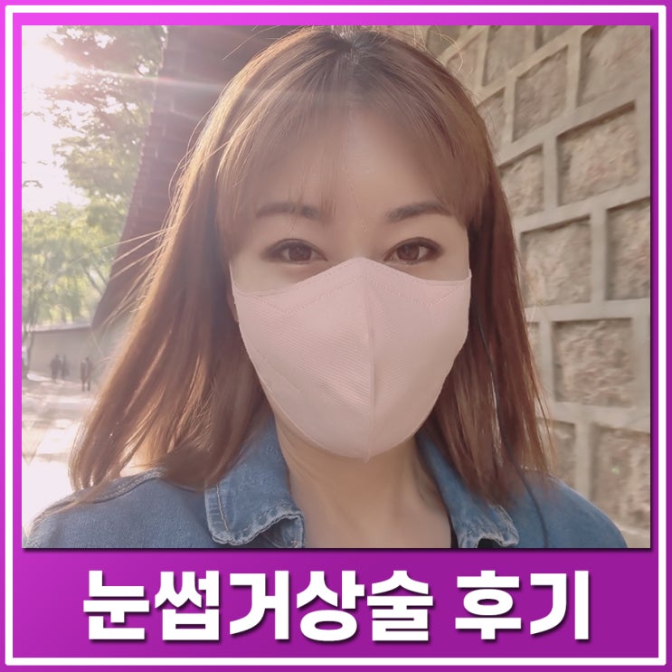  눈썹거상술 후기를 통해 눈꺼풀 처짐이 있는 중년 눈성형