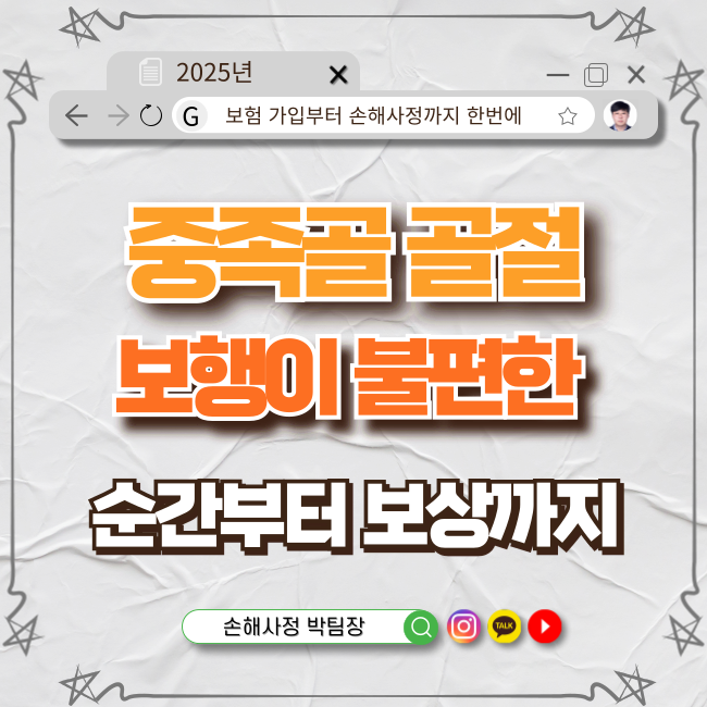  중족골 골절, 이렇게 대처하세요!