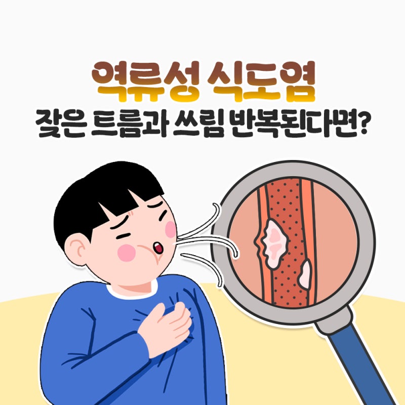 인천송도내과 역류성식도염 잦은 트름과 쓰림 반복된다면?