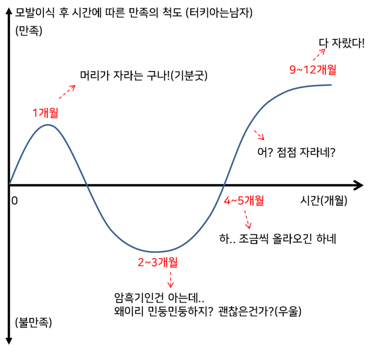  모발이식 후의 암흑기 과정 설명(알고도 멘탈 털리는 시기)