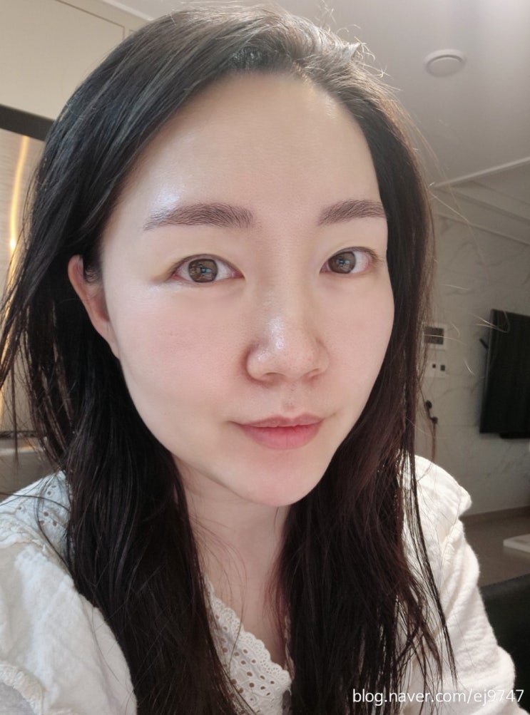  유성온천역피부과 텐써마300샷 일상생활 바로 가능한 고주파리프팅