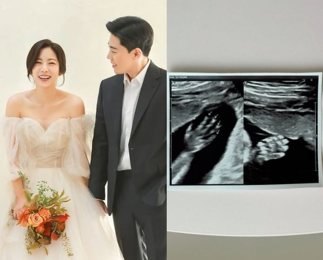  '1박 2일' 출신 PD반소영, 결혼 4년만 임신…'태명=칸쵸' 초음파 공개