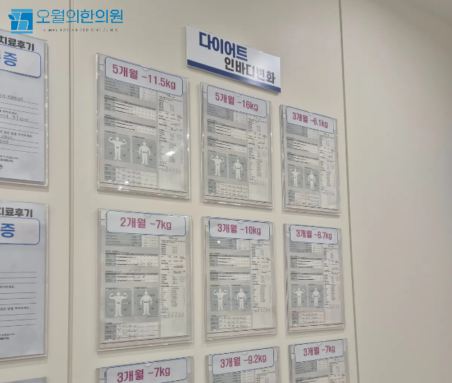 구미 다이어트 한의원, 하체비만 탈출, '3가지' 키포인트! (한의사 작성)