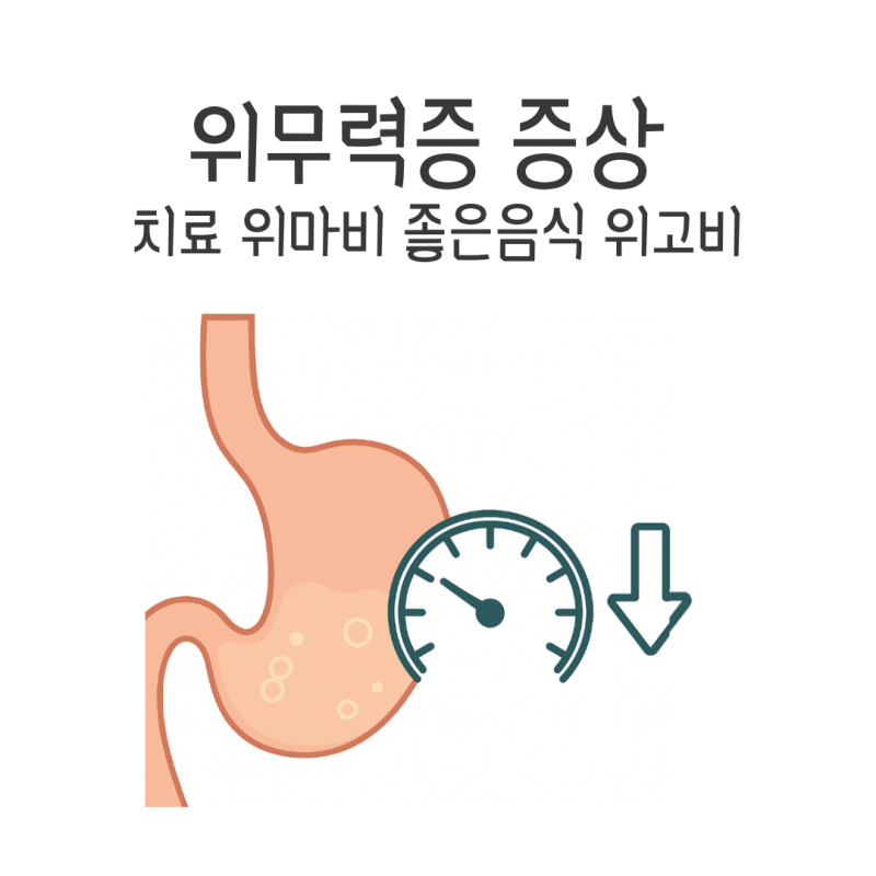 위무력증 증상 치료 위마비 위무력증에 좋은음식 위고비