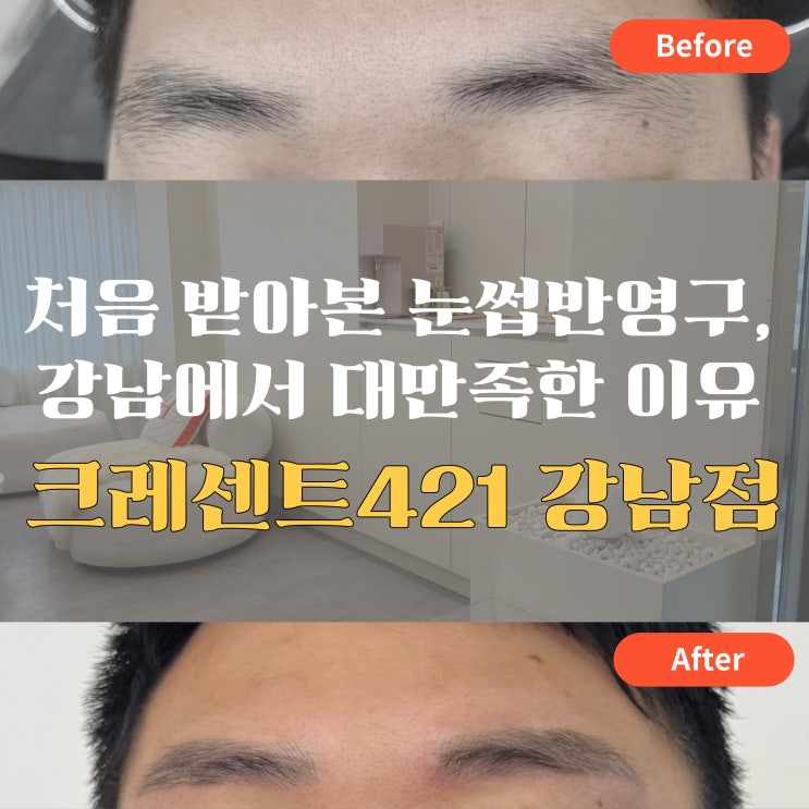 강남 눈썹반영구 | 남편과 함께 다녀온 크레센트421강남점 리얼 후기!(두피문신/자연눈썹문신/잔흔커버/붉은잔흔커버/망친눈썹커버)