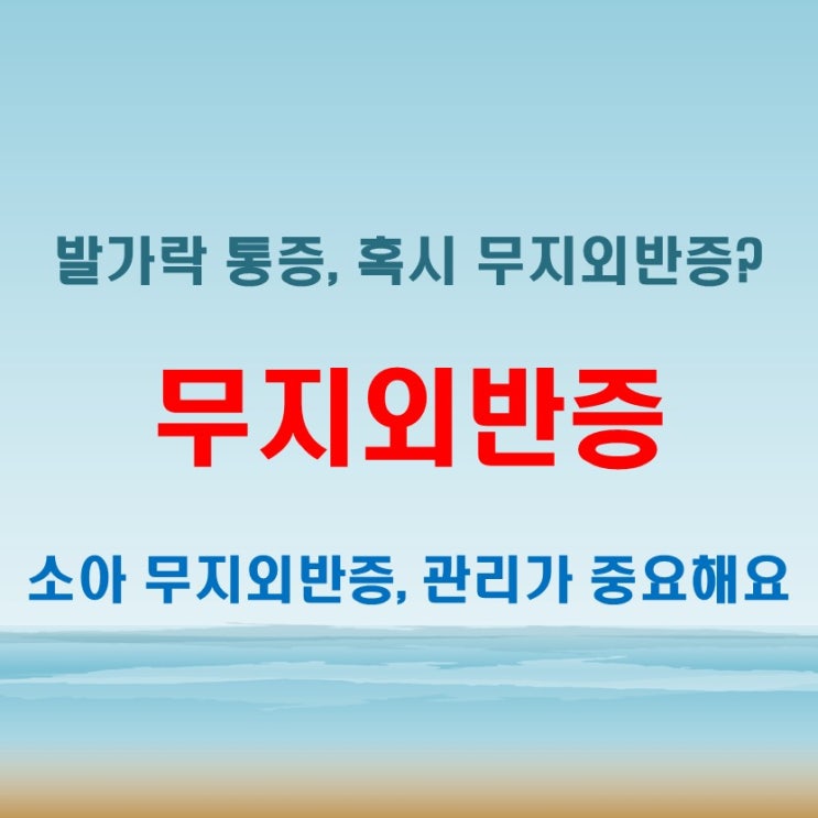  무지외반증 증상, 운동으로 완화 가능할까? 소아 기준 포함