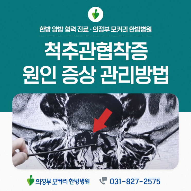  의정부한방병원 척추관협착증 원인과 증상, 관리방법