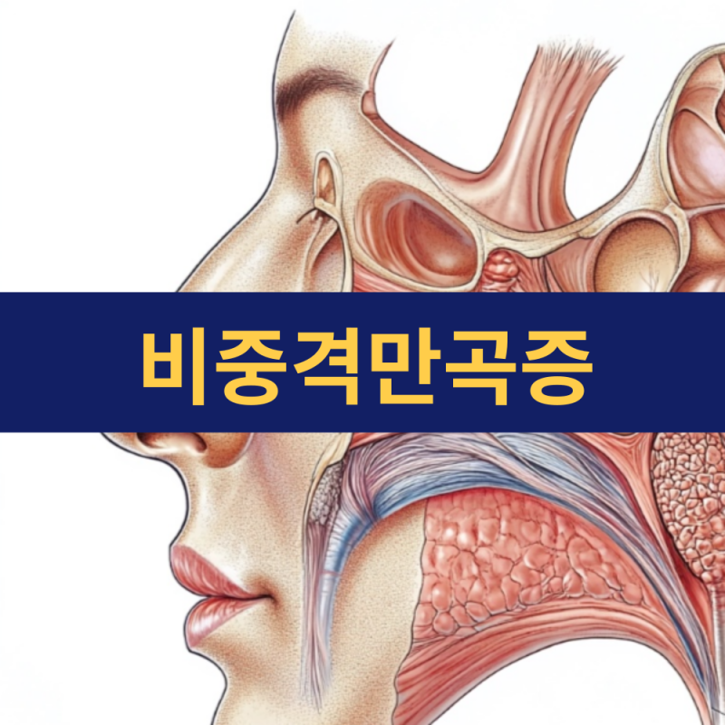 비중격만곡증 증상 | 비중격만곡증 코골이 수술 비용 보험 처리 가능 여부