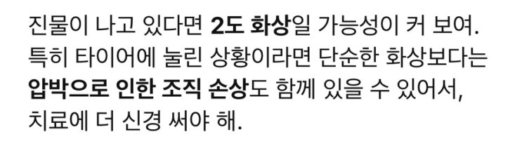  “엄마 내 발등에 닿지 마!” ._. 누가 보면 골절인줄 알겠네 “죄송”