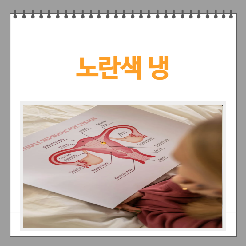 노란색 냉 질염 원인 치료 방법은?