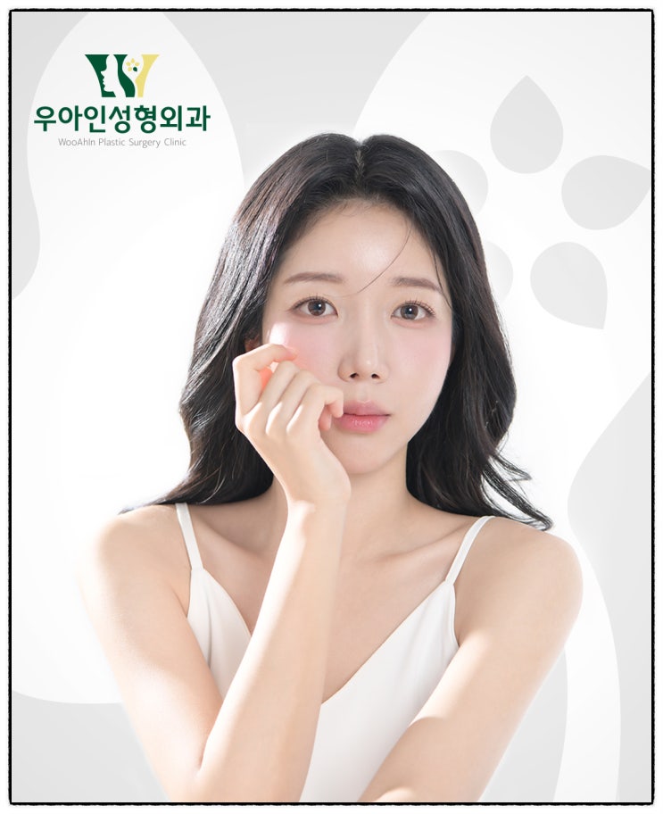  성형외과 리얼모델 모집 & 신청 방법