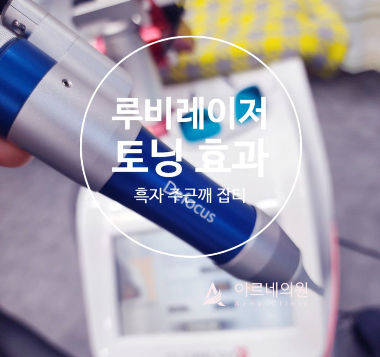  루비토닝 기미 딱지 레이저 가격과 부작용은? 아르네의원