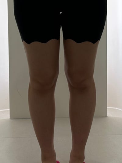 다이어트 고민하다 선택한 아아주사 솔직 후기 : 운동으로 안 빠지던 허벅지 안쪽·승마살, 1주 후 라인 변화까지