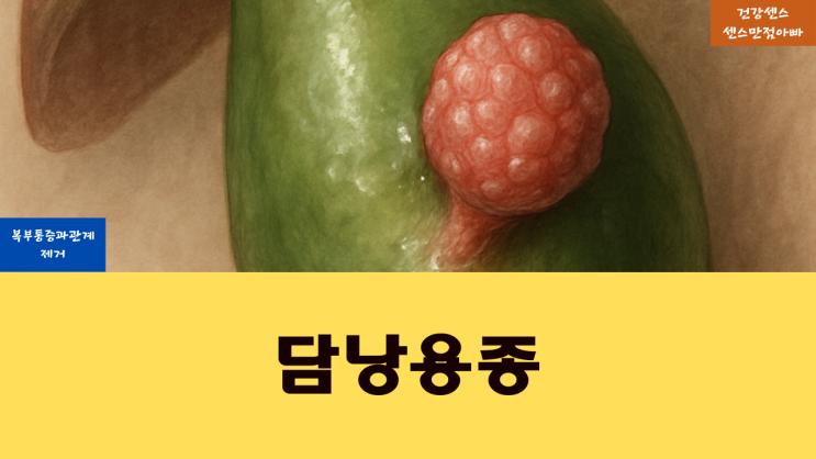  복부 통증과 담낭 용종 관계 및 제거는?