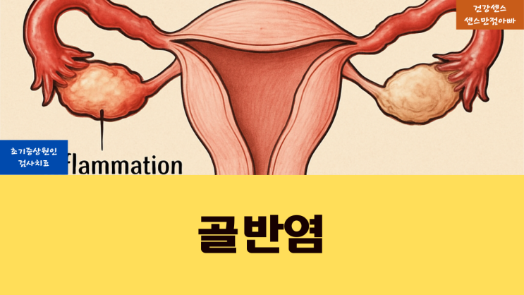  골반염 초기 증상 원인 및 검사 치료