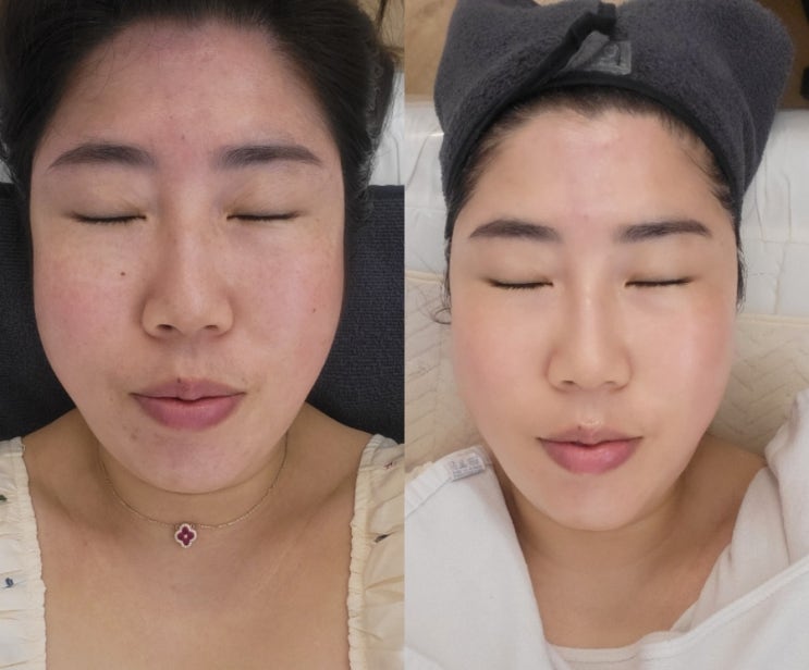  [명륜동]화사하고 밝은 피부연출을 위한 부산 비타민관리 '올가드림뷰티 명륜점'