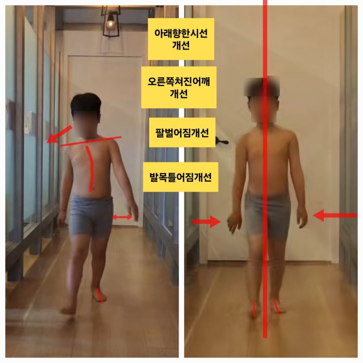  [부산 동래 걸음걸이 교정] 어린이 보행교정, 10회 레슨 후기