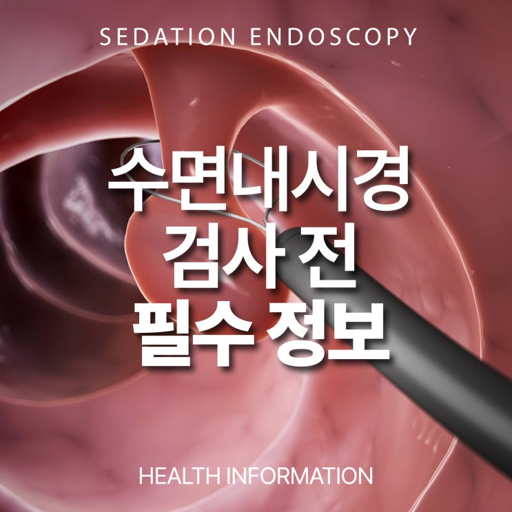 수면 위내시경·대장내시경 검사 전 꼭 알아야 할 필수정보