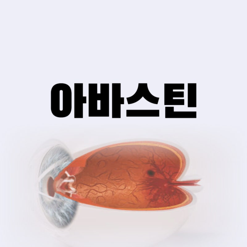 아바스틴 주사 비용, 부작용까지 총정리! 황반 변성, 항암치료에 꼭 알아야 할 정보