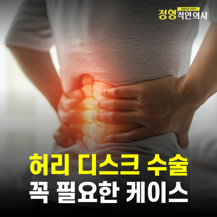 허리디스크 이럴때는 수술 안하면 평생 후회한다!  (의사 작성)