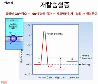 칼슘 농도 장애의 저칼슘혈증