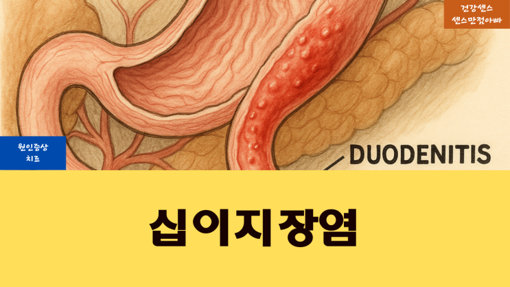  십이지장염 원인 증상 및 치료