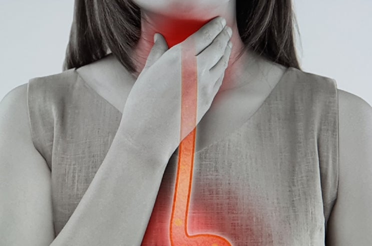  역류성 식도염 초기증상 6가지? 신물 올라올때 원인 자가치료 및 좋은 음식