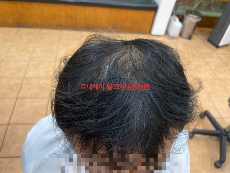  남자탈모헤어스타일 엠자 정수리탈모 해결위해 김해에서왔다구요? 부산사상르네시떼미용실/ 개금주례학장하단남포명지초량범일범천양정망미수영광안해운대반송미남토곡경남경북전라강원제주경기서울