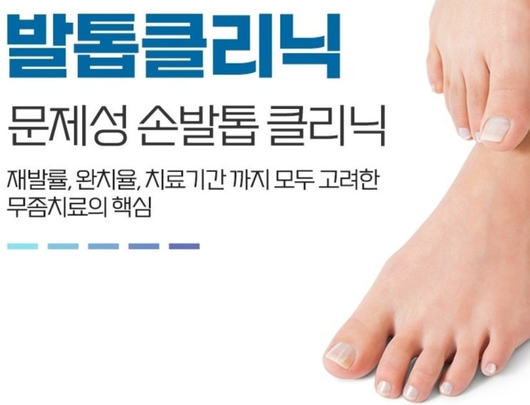  평택내성발톱무좀 치료: 평택라이프365의원에서 문제성손발톱클리닉하세요!