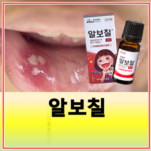 알보칠 구내염 혓바늘 가격 효과 사용법