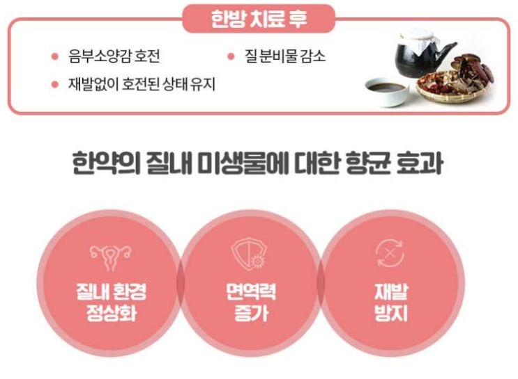  안양질염 재발 방지를 위한 치료방법
