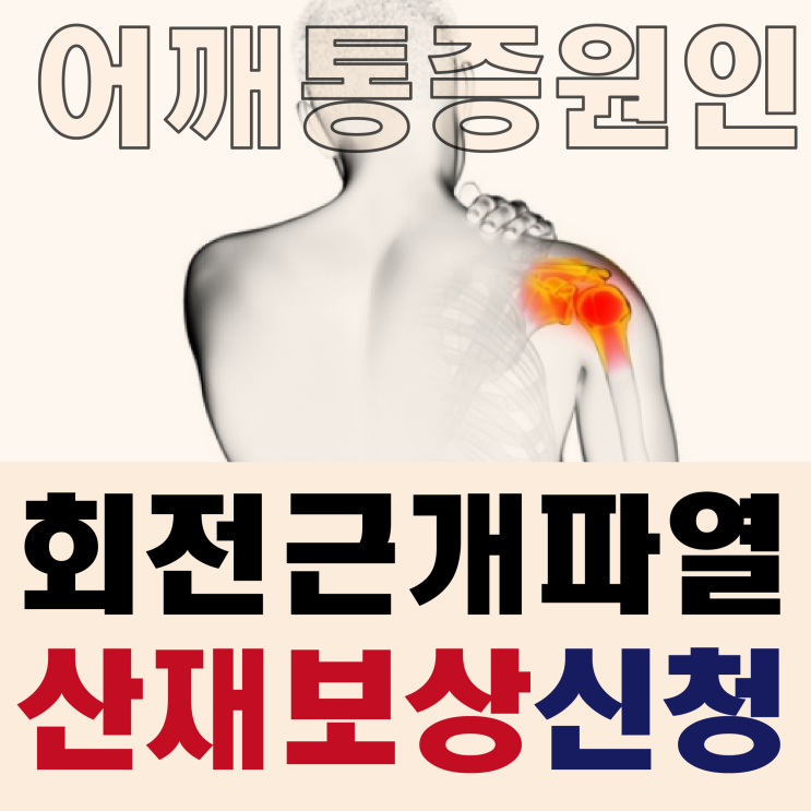  [어깨통증 원인] 회전근개파열 산재보상 신청하려면?