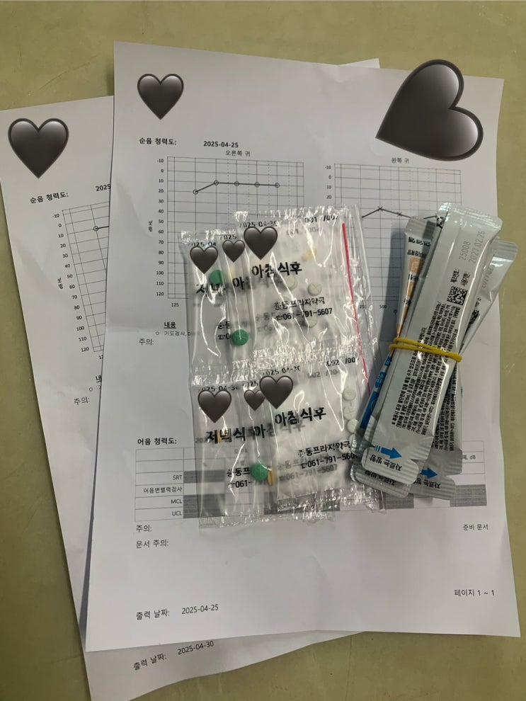  [돌발성 난청의 모든 것] -  청력검사결과지 보는 법 | 치료법•기간 | 주의사항 | 재발 (+메니에르병)