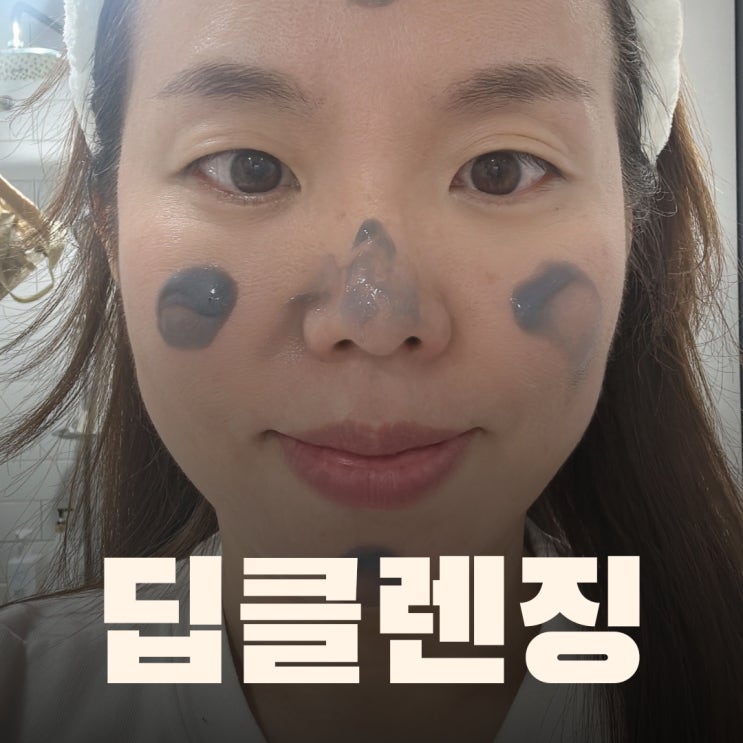  닥터바이오덤 / 순한 복합성 딥클렌징폼 추천