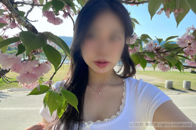  신사역피부과 울쎄라프라임 100샷 리프팅 내돈내산 팔자주름 효과 통증 후기