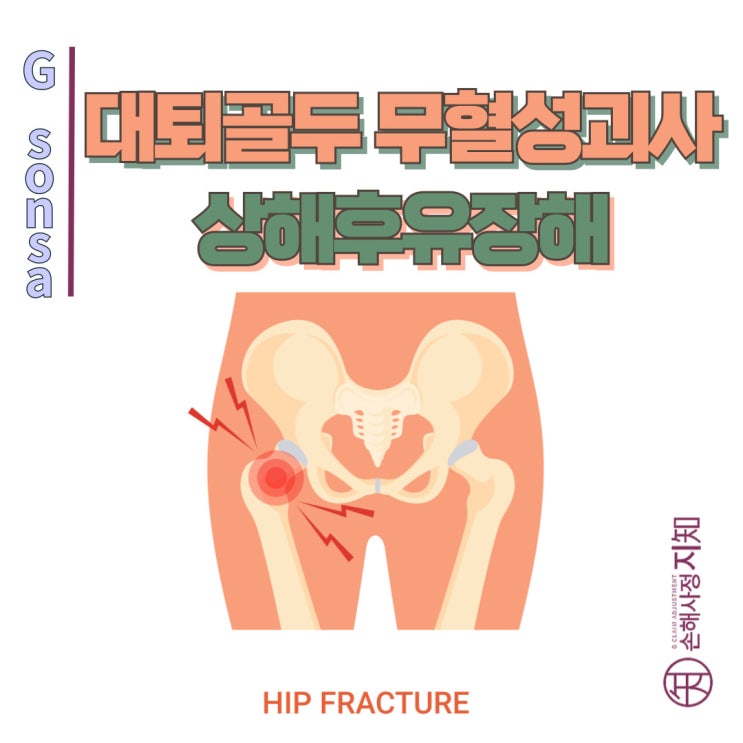  대퇴골두 무혈성 괴사, 스테로이드 부작용도 상해후유장해 받을 수 있을까? - [보험금, BA+DA]
