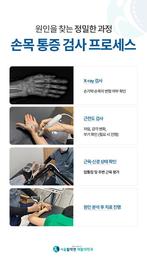 Causes and Treatments of Wrist Pain — 본문 그림