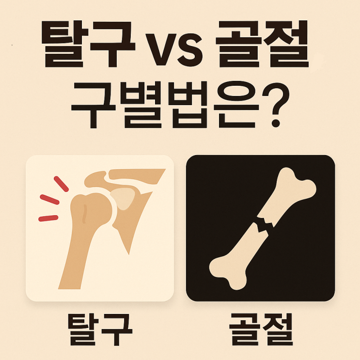  탈구 골절 차이, 제대로 아시나요? 응급처치 완전 정리