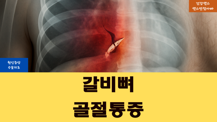  갈비뼈 골절 통증 원인 증상 및 수술 치료