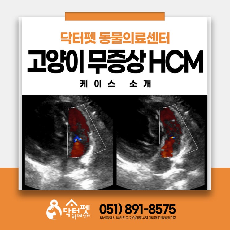  스코티쉬 스트레이트 무증상 HCM 4년간 어떻게 관리했을까요? 부산 고양이 심장병 검진 조기진단 동물병원