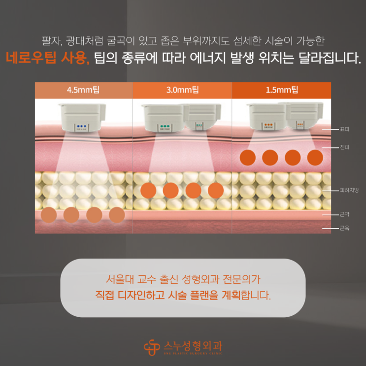  울쎄라와 진정(수면) 마취, 한국과 세계 시술방식의 차이점