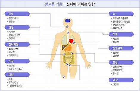  알코올성 케톤산증