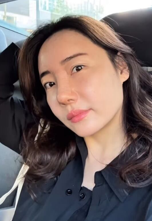  ‘조혜련 올케’ 박혜민, 3번째 코 수술... “긴장 늦출 수 없다”