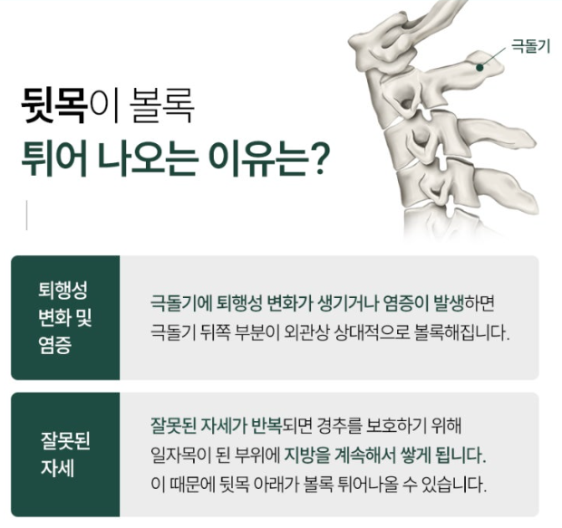  동래피부관리 일자목 거북목 "버섯증후군"