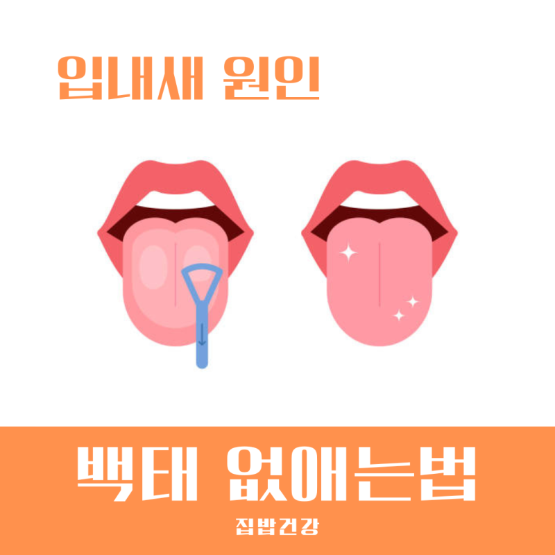 혓바닥 백태 없애는법 원인은