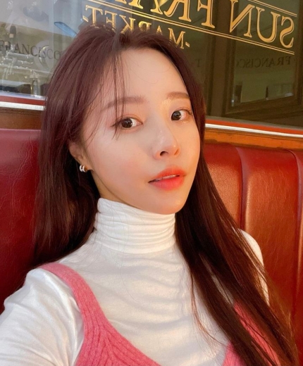'암 투병' <b>이솔이</b>, <b>항암치료 후유증</b> 고백…"눈썹 빠지고 손도... 